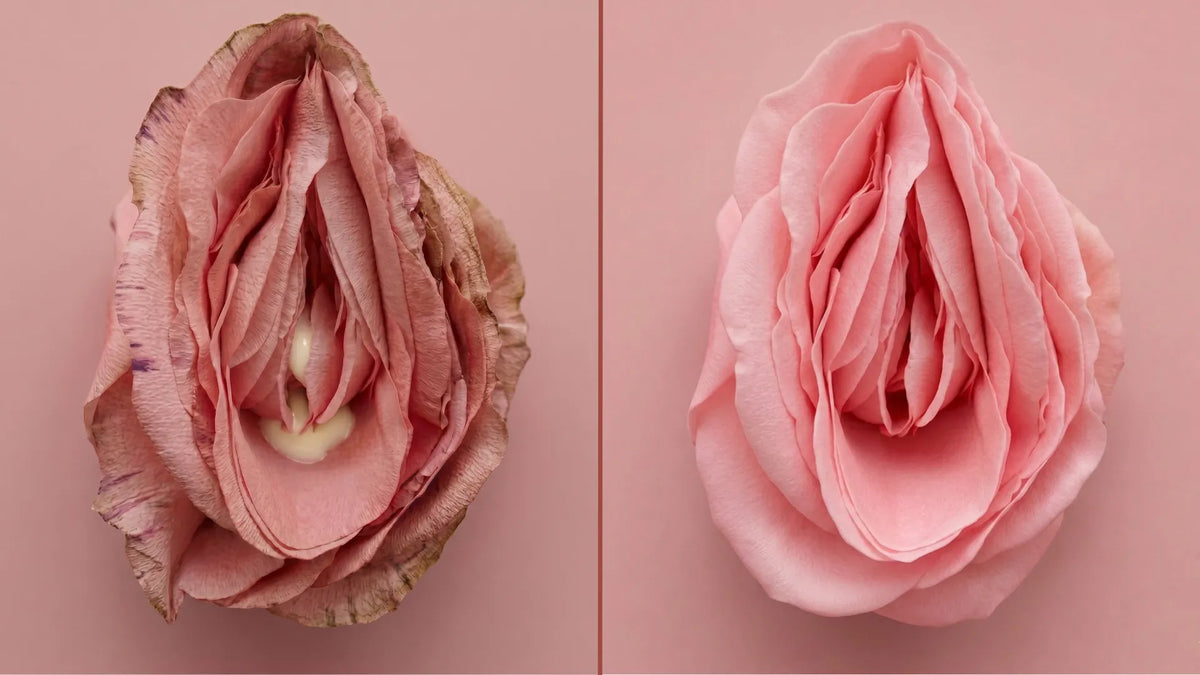 Flow comparison image